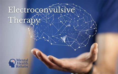 electroconvulsive therapy for mental health